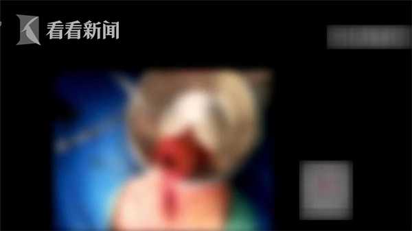 供卵试管婴儿降调通常需要多长时间