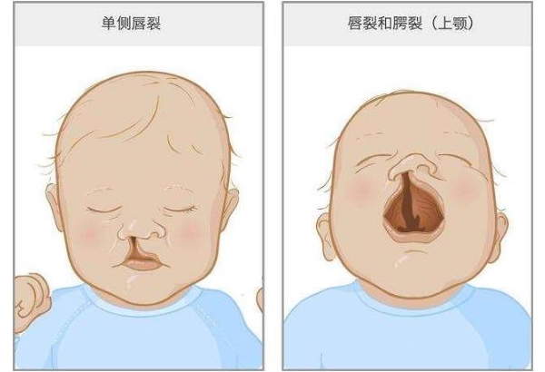 供卵试管婴儿专家。欢乐颂2》的家庭遗传心理会不会影响孩子