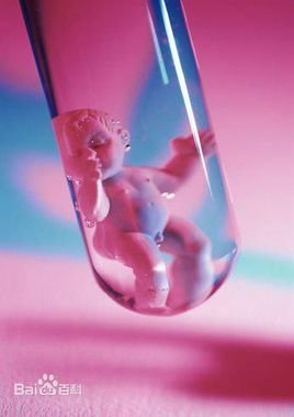借卵试管婴儿胸水后腹水-借卵试管婴儿移植后胸腹水的症状