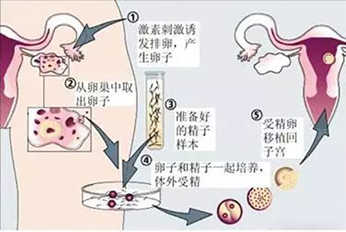 做供卵试管费用高吗